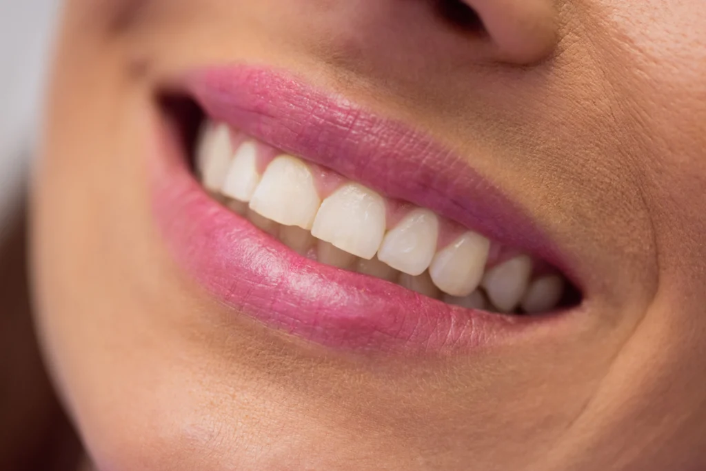 contorneado-dental-tarjeta