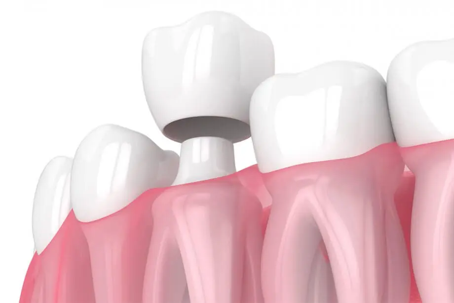 corona-dental