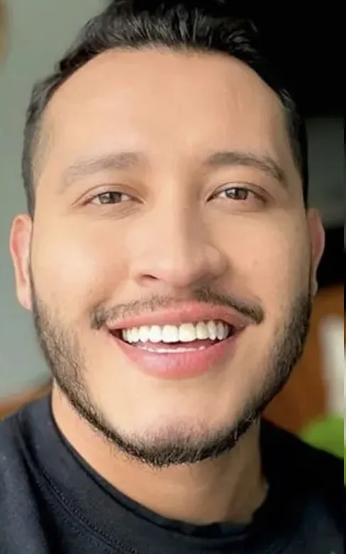 invisalign en sevilla antes y despues - despues