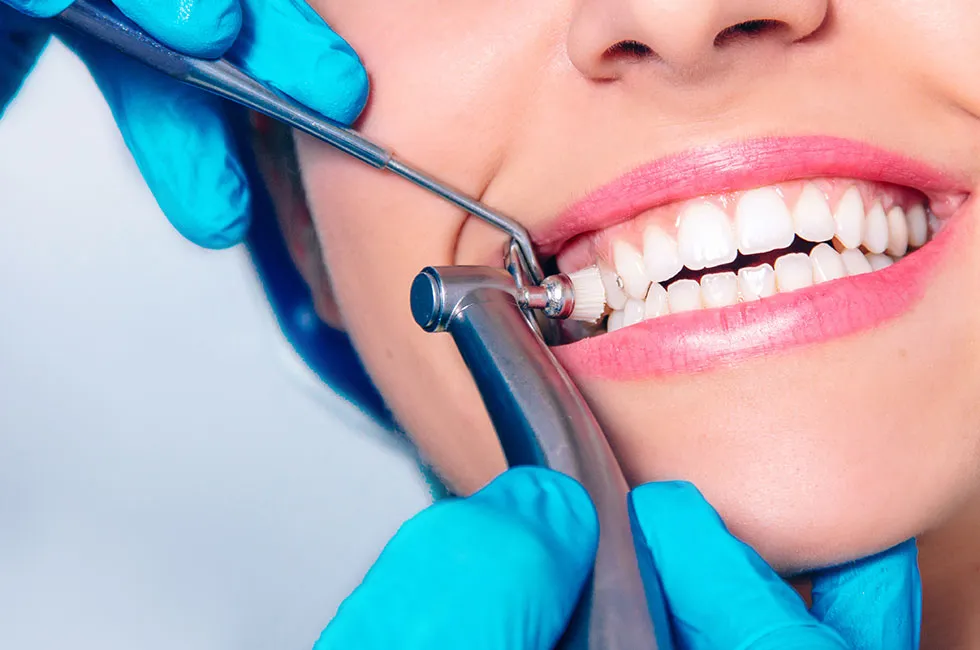 limpieza-dental-sevilla