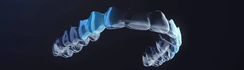 porque-poner-el-invisalign