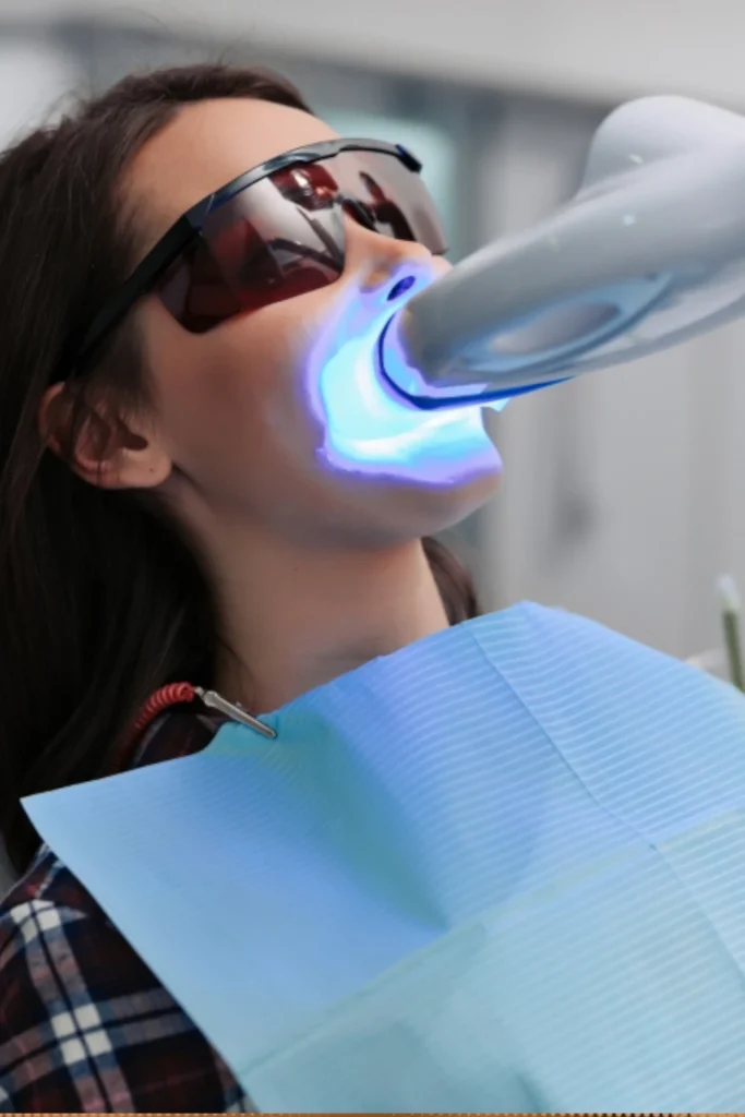 tarjeta blanqueamiento dental