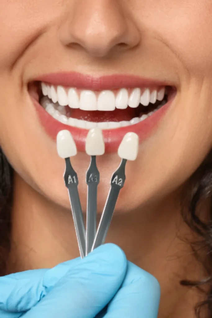 tarjeta carillas dentales