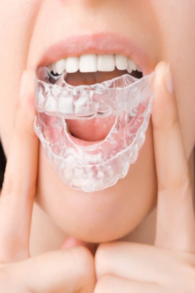 tarjeta ferulas dentales bruxismo