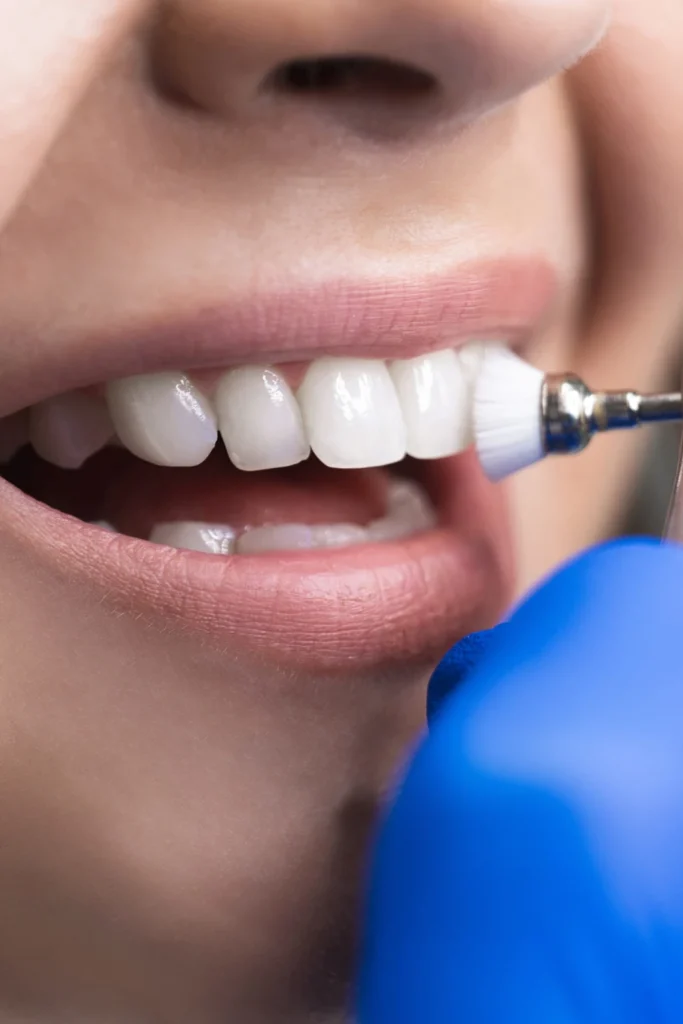tarjeta-odontologia-preventiva