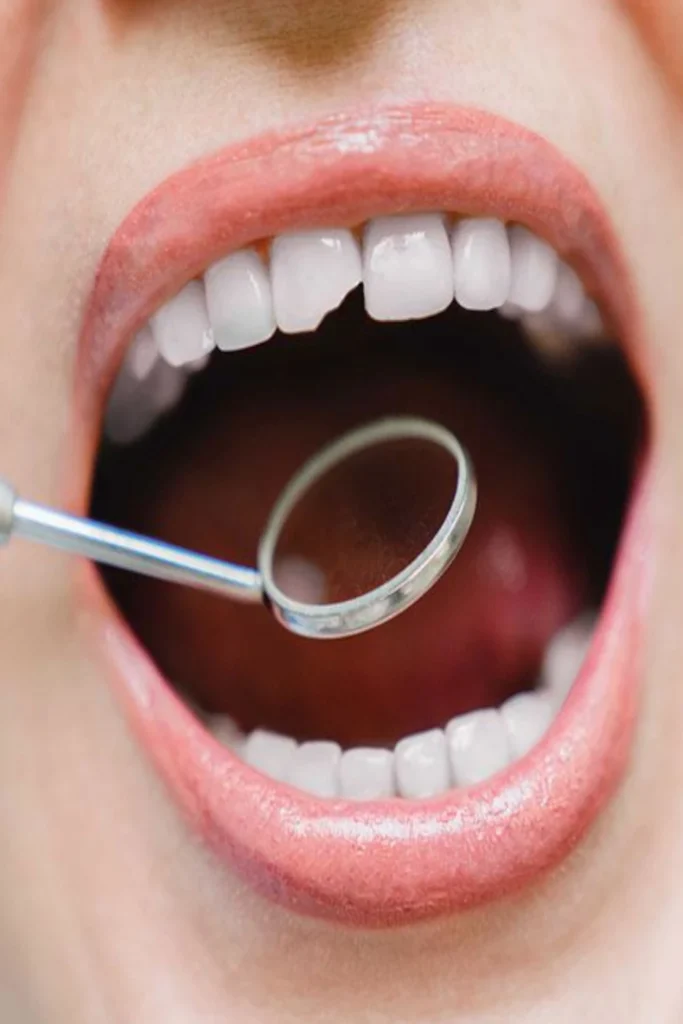 tarjeta reconstruccion-dental